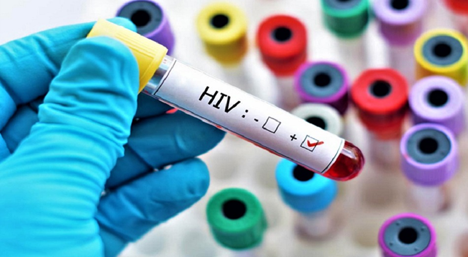 Leia mais sobre o artigo Estudo sugere que segundo paciente com HIV foi curado do vírus