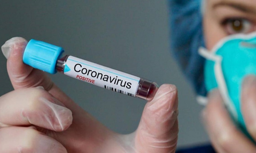 Leia mais sobre o artigo Acre registra 1 óbito e 204 novos casos de coronavírus nesta terça (24)
