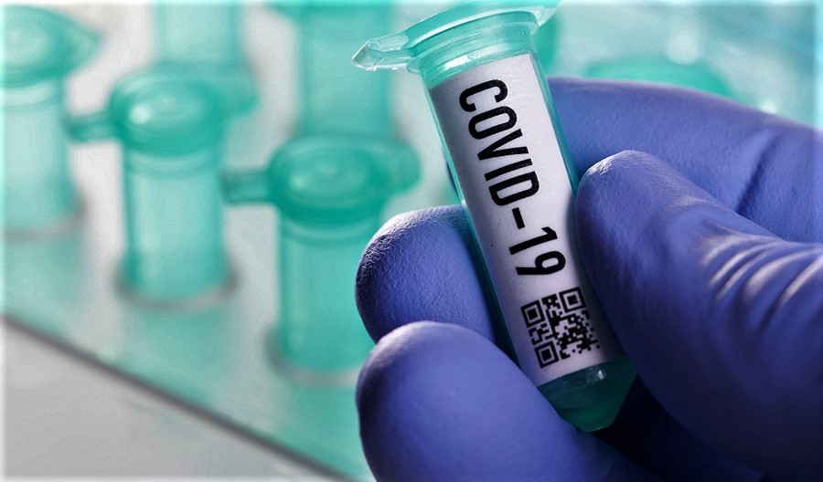Leia mais sobre o artigo Acre registra 4 mortes e 113 novos casos de coronavírus nesta sexta (7)