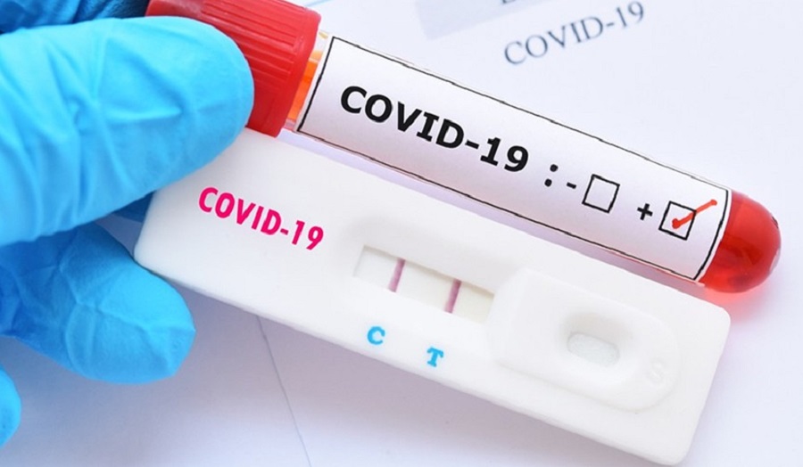 Leia mais sobre o artigo Acre registra 183 novos casos de coronavírus nesta quarta (26)