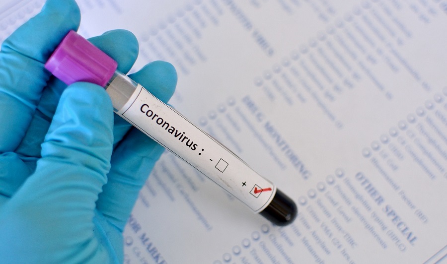 Leia mais sobre o artigo Acre registra 10 mortes e 193 novos casos de coronavírus nesta quarta (15)