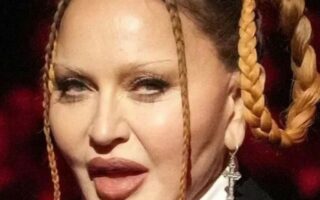 Madonna chama atenção no Grammy por alterações estéticas