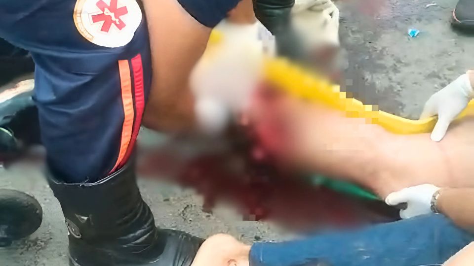 Leia mais sobre o artigo Grave acidente na BR-364 deixa homem com perna mutilada e em agonia no Acre