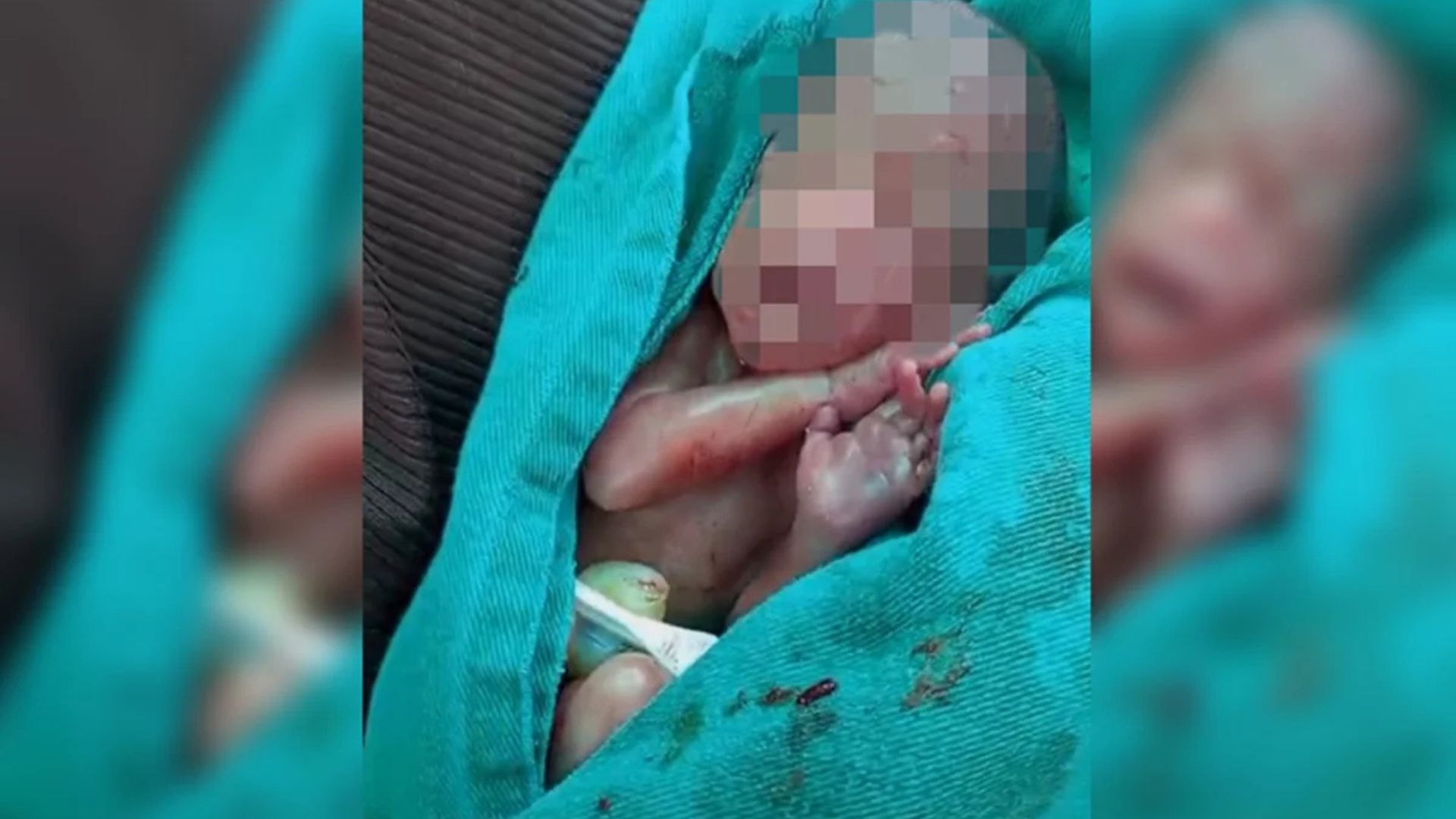 Leia mais sobre o artigo Bebê declarado morto e que voltou a respirar morre na UTI