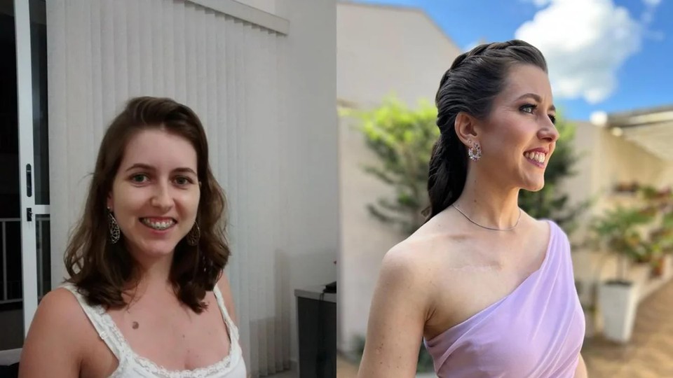Leia mais sobre o artigo Dez anos após vencer melanoma, paciente ainda vive com medo da doença
