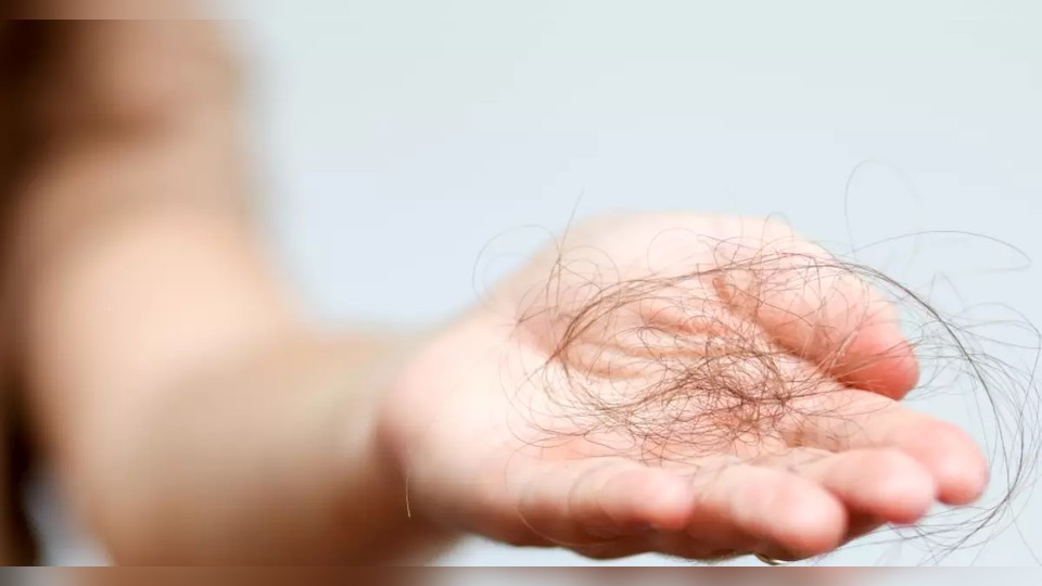 Leia mais sobre o artigo O que o inverno tem a ver com a queda de cabelo? Entenda essa relação