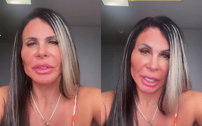 Leia mais sobre o artigo Gretchen retoca harmonização facial: “Sem manutenção não tem vitória”