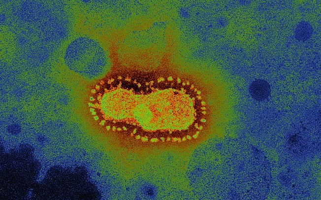 Leia mais sobre o artigo Brasil tem 58 casos suspeitos de reinfecção por Covid-19 e só um confirmado