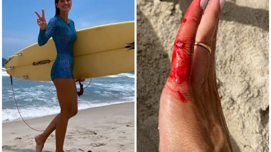 Leia mais sobre o artigo Isabella Fiorentino se machuca após dia de surfe