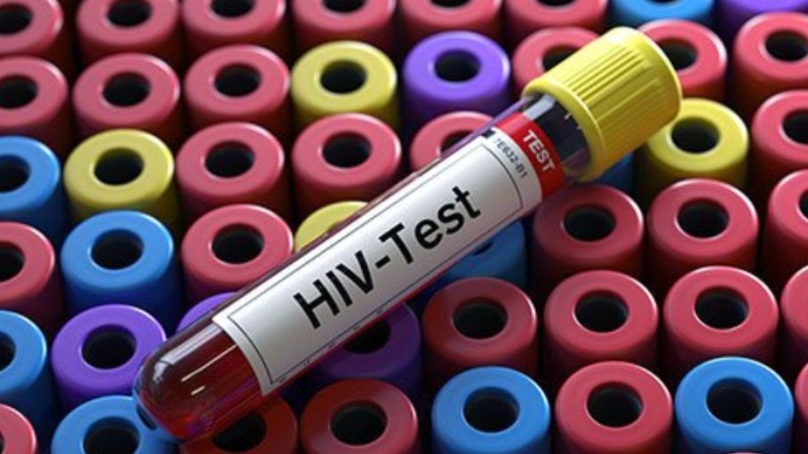 Leia mais sobre o artigo Universidades brasileiras testam eficácia de vacina contra o HIV